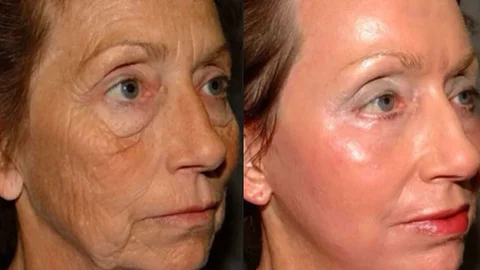 امسحي التجاعيد في أسبوعين بـ 3 قطرات يوميًا! امسحي التجاعيد في أسبوعين بـ 3 قطرات يوميًا!